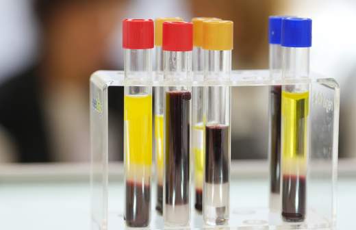 Анализ ДНК поможет раскрыть тайну древних захоронений